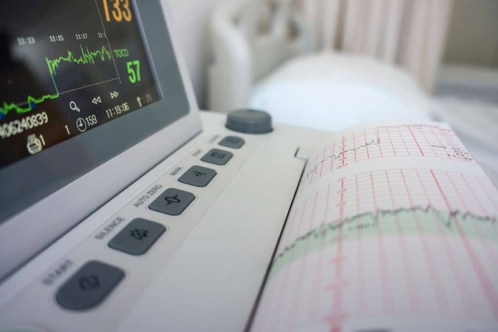 Le monitoring pendant l'accouchement naturel est ponctuel mais régulier